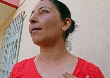 Antalya’da tırtılları süpürdü, hastanelik oldu