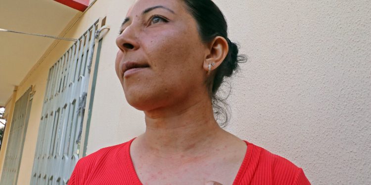 Antalya’da tırtılları süpürdü, hastanelik oldu