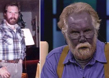 İlaçla Şirin Baba’ya dönüştü! Mavi deri hastası Paul Karason’un inanılmaz hikayesi…