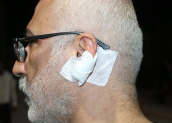 ‘Gamsız’ kelimesi başına iş açtı! Diyarbakır’da gazeteciye tekme, yumruk ve bıçaklı saldırı