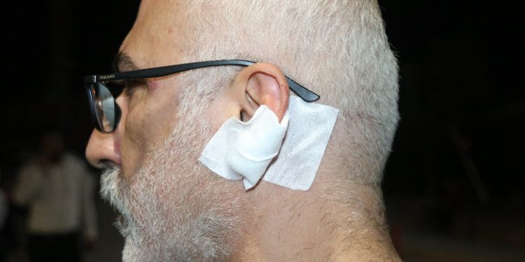 ‘Gamsız’ kelimesi başına iş açtı! Diyarbakır’da gazeteciye tekme, yumruk ve bıçaklı saldırı