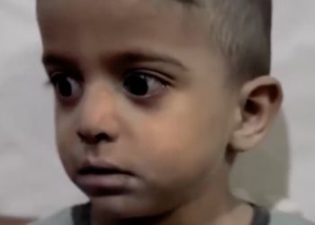 İsrail bombardımanında şoka giren Gazzeli Muhammed’in yüzü güldü