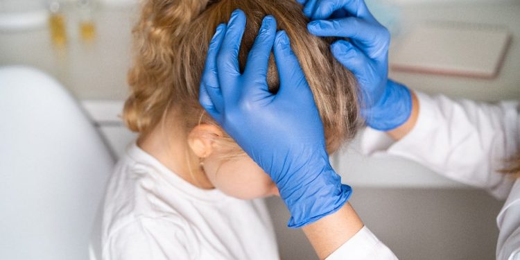 Saçta bit oluşumu, belirtileri ve tedavi yöntemleri